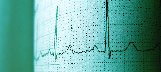 12-Lead ECG Interpretation